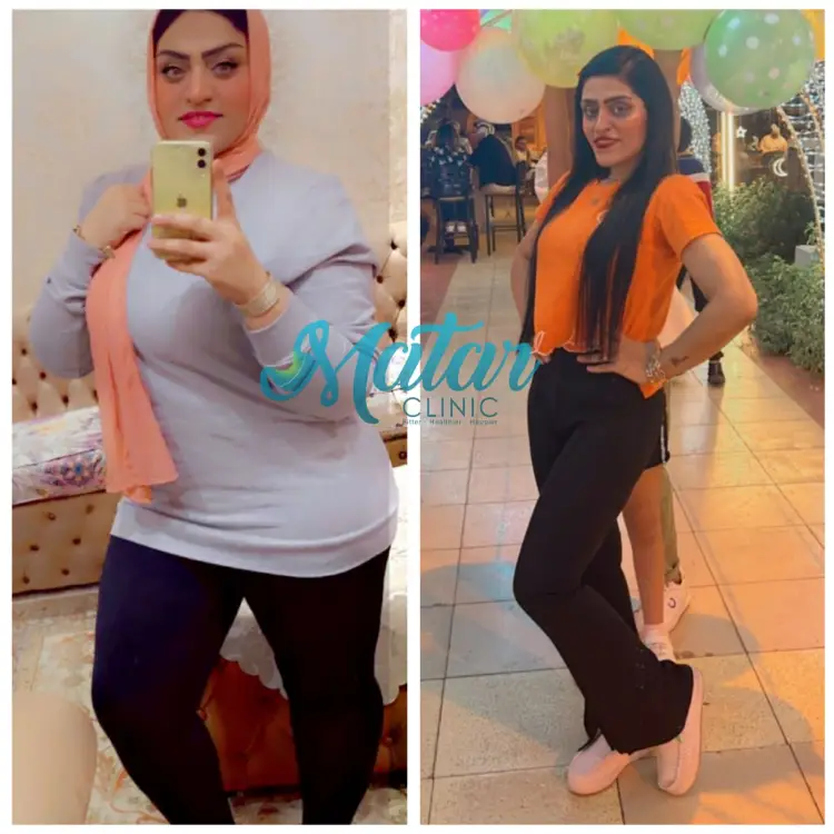 تكلفة عملية تحويل المسار تكلفة عملية تحويل المسار